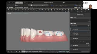 パワーリッジの注意点