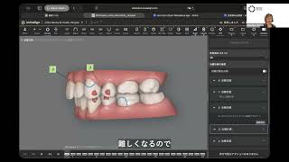 リトラクションとトルクの関係