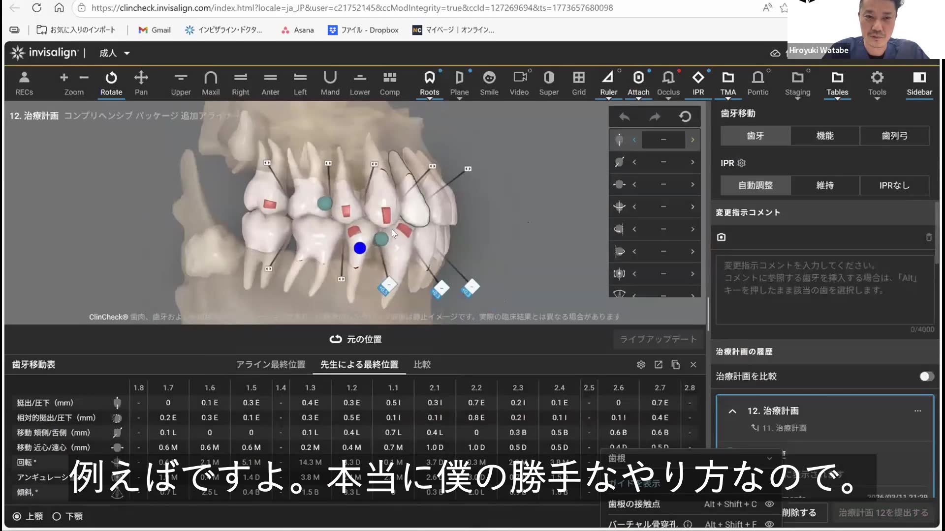 実現性の高い動き