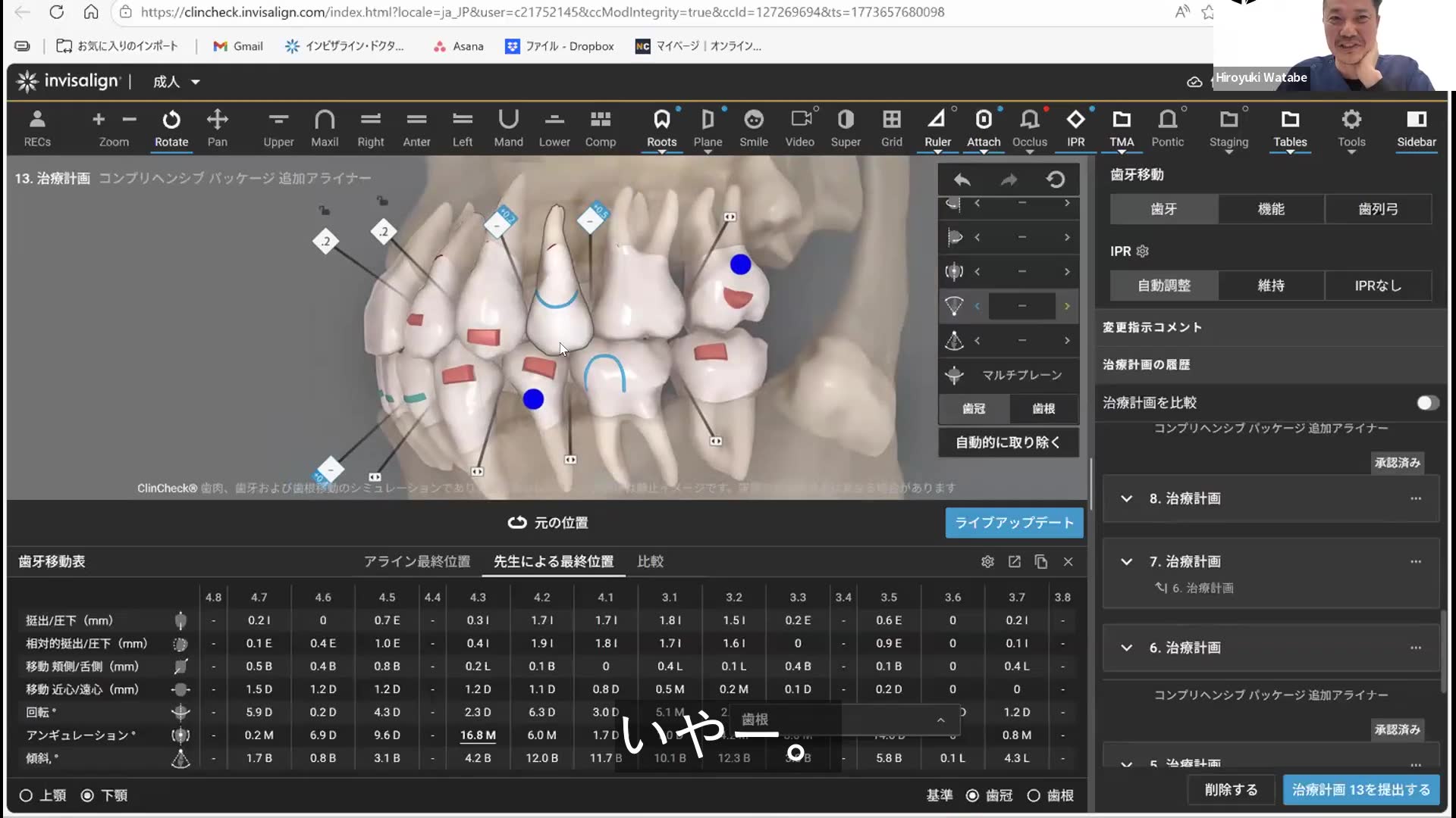 歯根が接触している場合の対応策