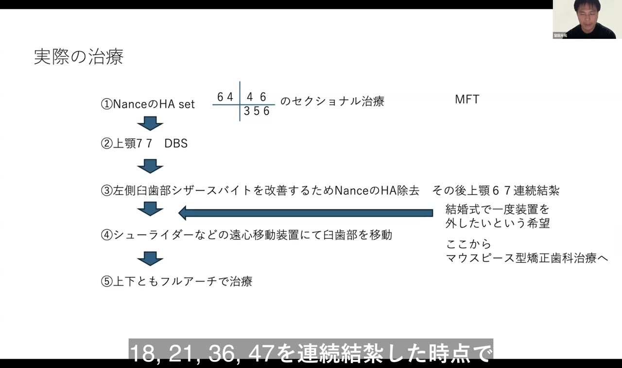 治療中断と装置選択の判断