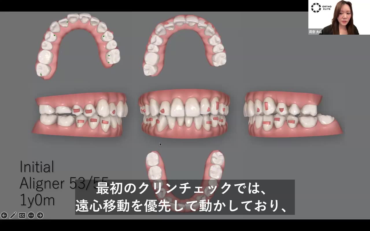 ステージングの反省点
