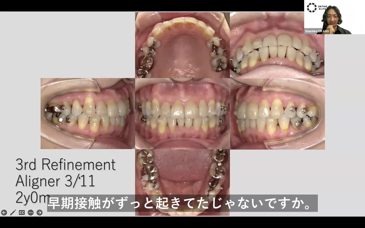 7番の移動とアタッチメント