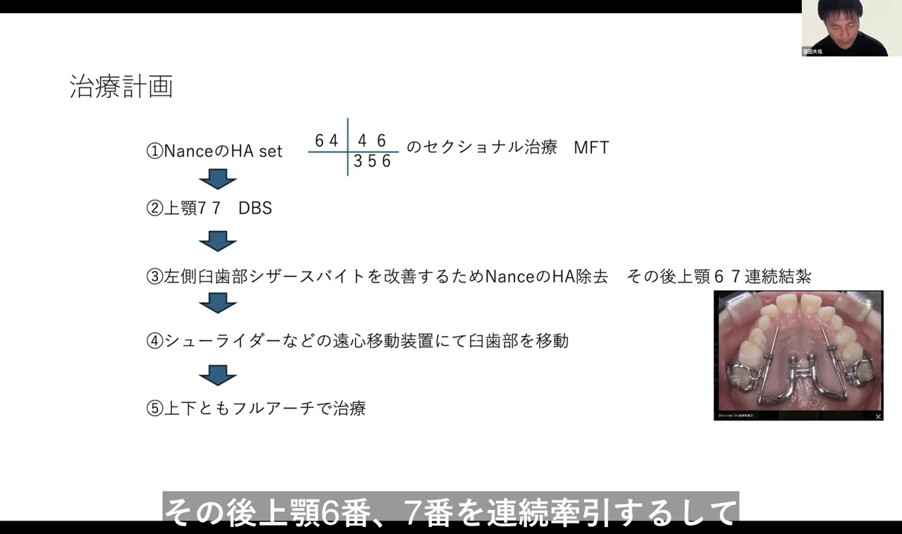 叢生量とスペースマネジメント