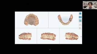 装着時の注意点