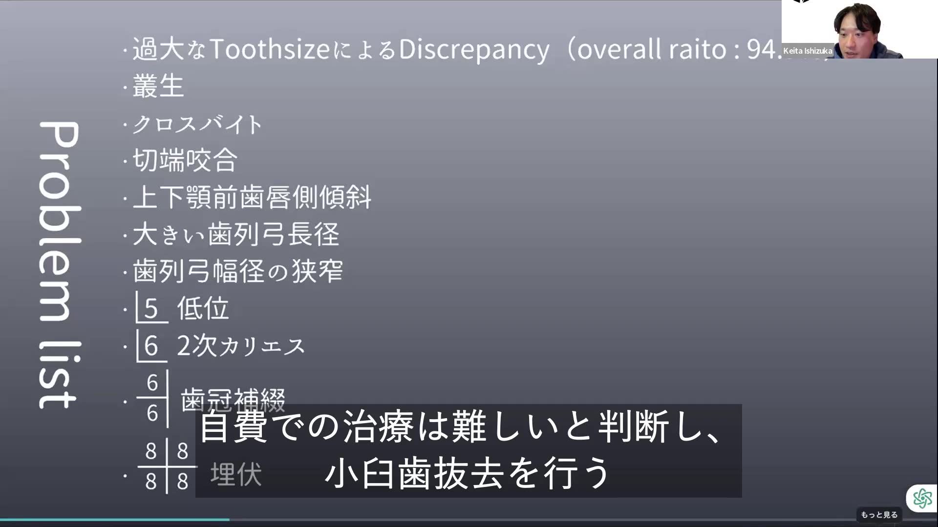 抜歯部位の選択とアンカレッジ